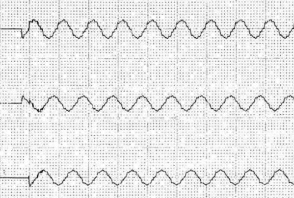 電容補償柜用晶閘管開關投切時波形圖
